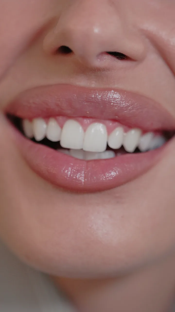 MR Smile — Osmeh koji se pamti